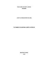 Monografia Johny Jeferson Pereira Lima.pdf